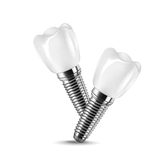 Cost of Dental Implants