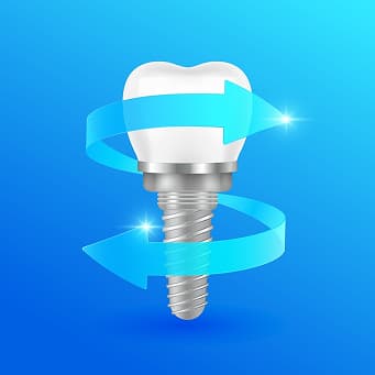 Dental Implant Technology