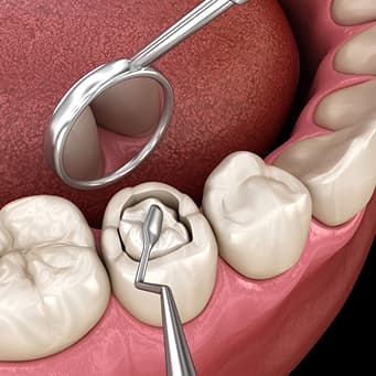 Restorative Dentistry