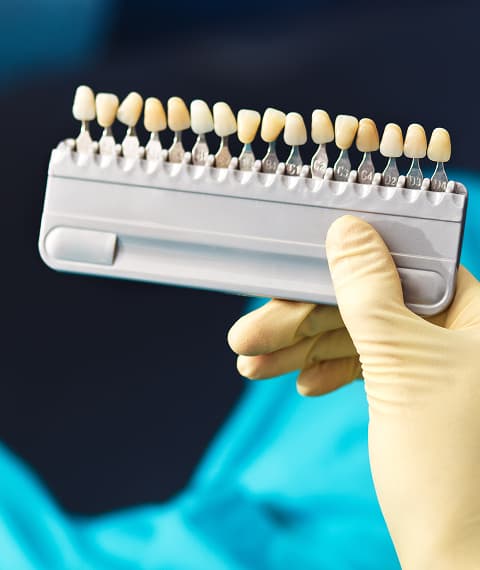 What Are Porcelain Veneers?