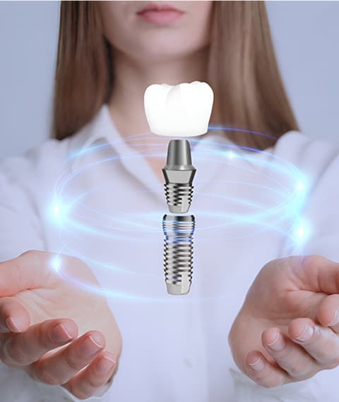 Dental Implant Aftercare & Support
