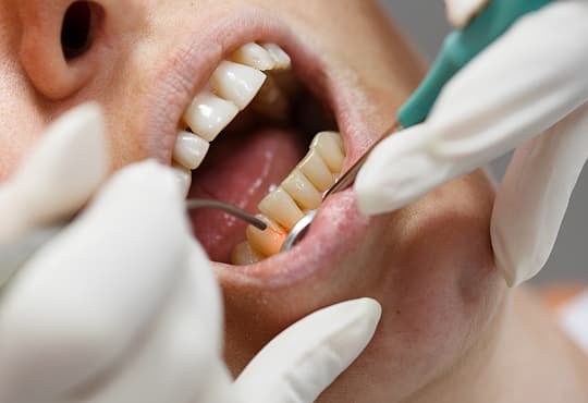 Soft Tissue Lasers