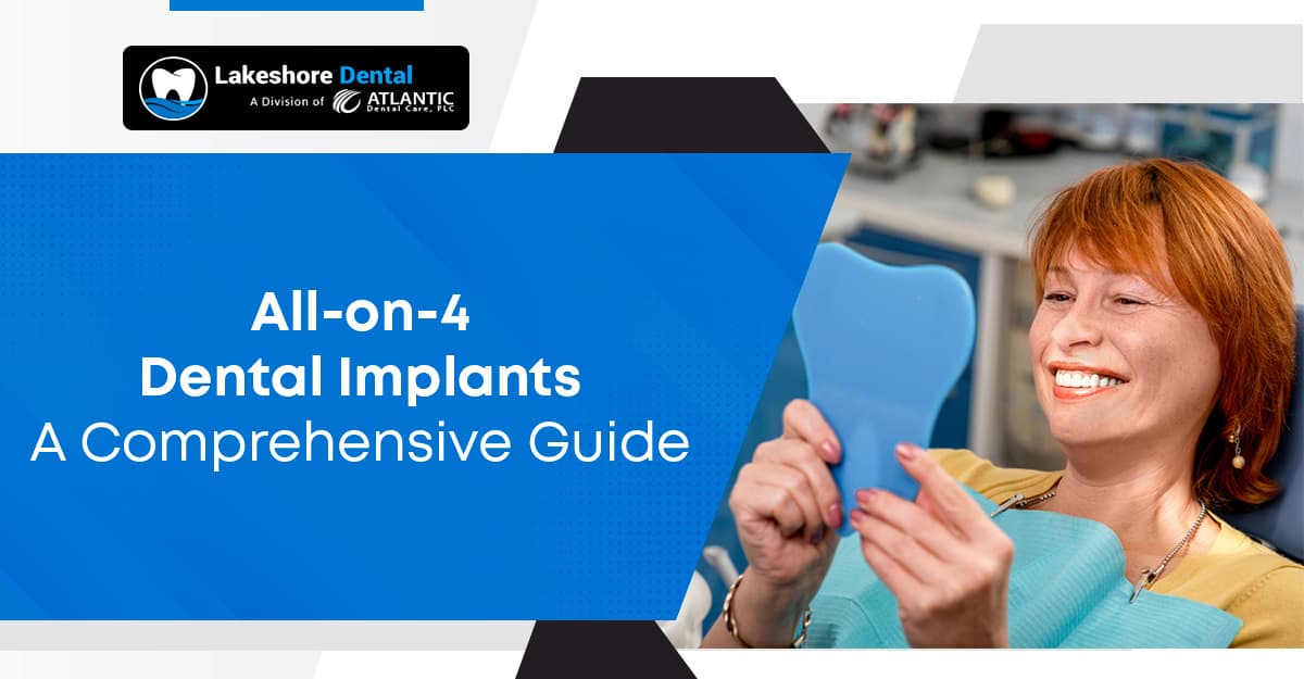 All-on-4 Dental Implants: A Comprehensive Guide