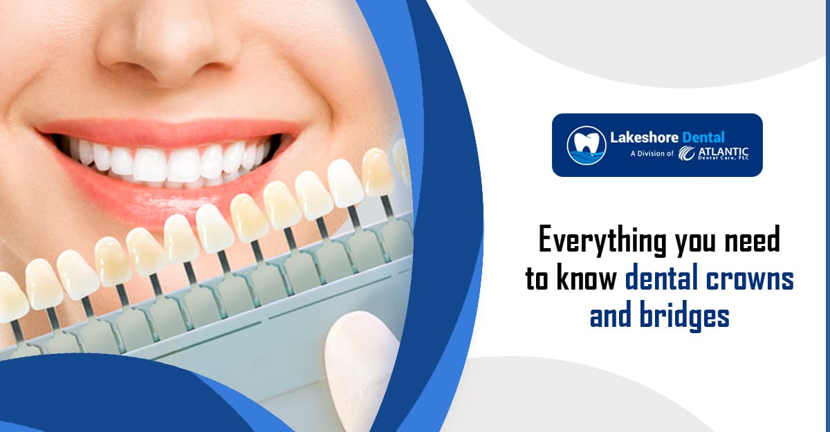 Everything You Need to Know About Dental Crowns and Bridges