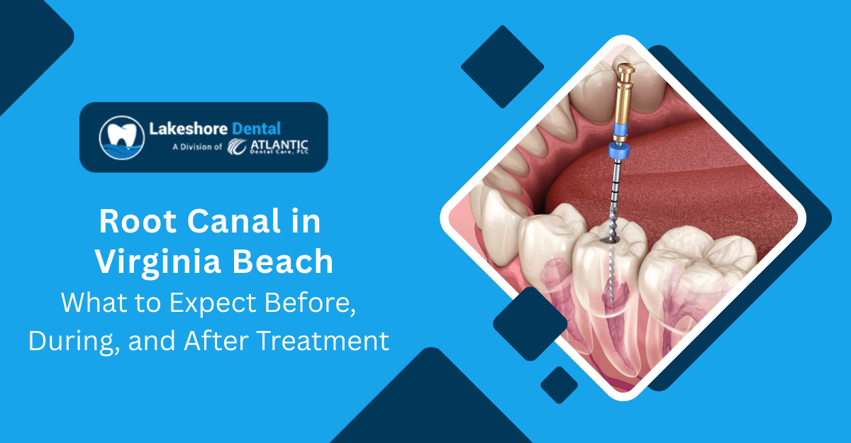 Root Canal in Virginia Beach: What to Expect Before, During, and After Treatment