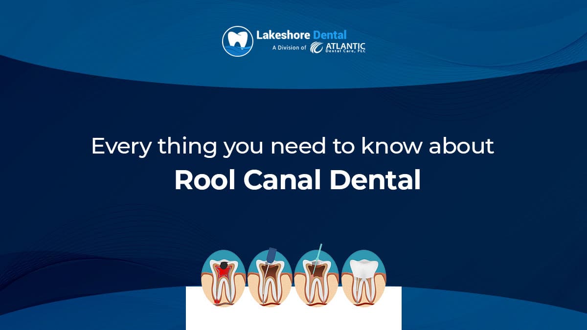 Everything you need to know about Root Canal Dental