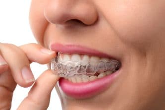 Should You See a Dentist for Invisalign or Can You Do It Yourself?