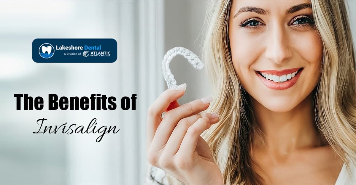 The Benefits of Invisalign
