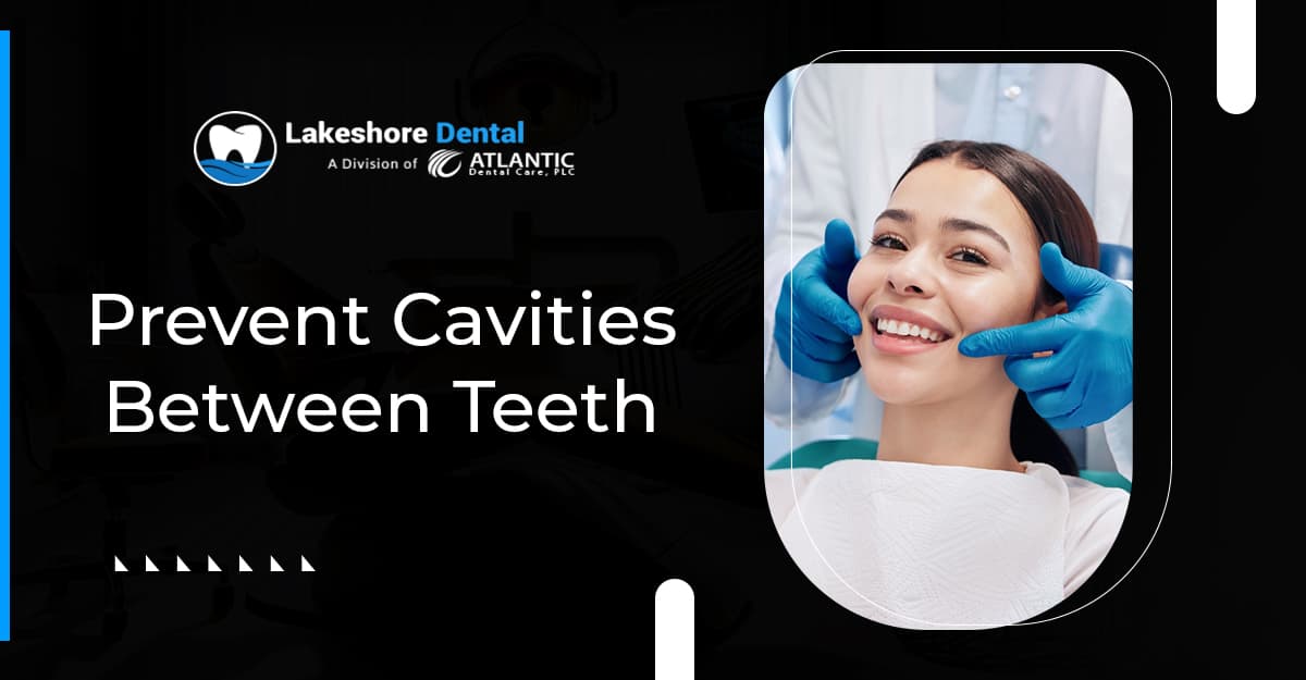 Cavities Between Teeth: The Hidden Dental Issue